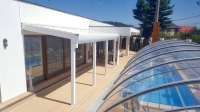 PERGOLA RETRACTABILA - PERGOLA RETRACTABILA